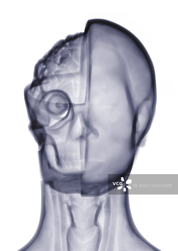 解剖模型，X光图片素材