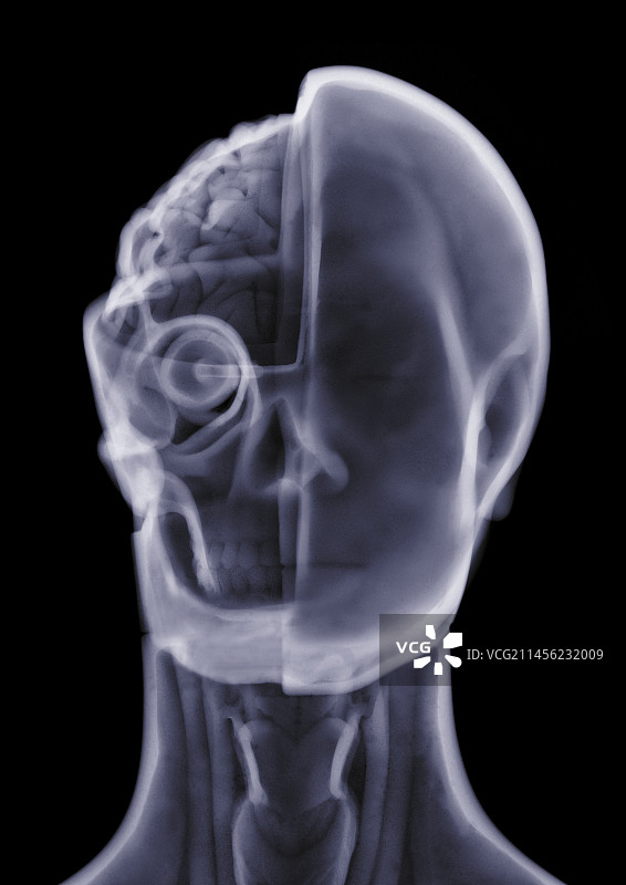 解剖模型，X光图片素材