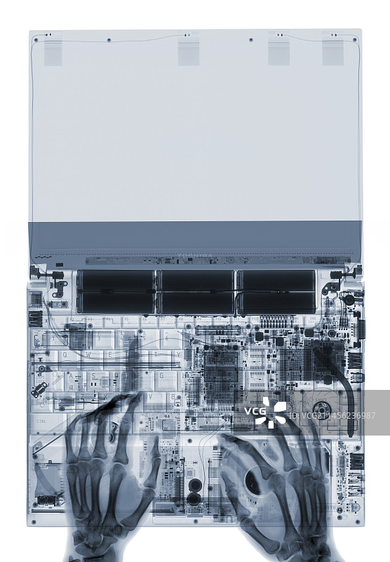 手部在笔记本上打字，X光视角图片素材