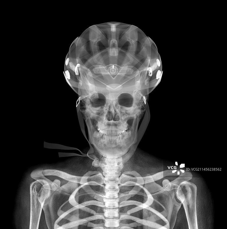 骷髅和头盔X光片图片素材