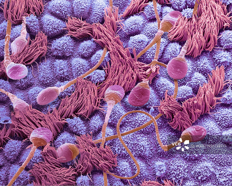 输卵管内的精子，扫描电子显微镜图图片素材