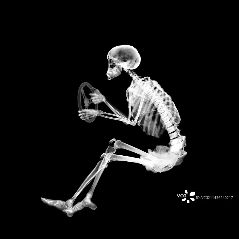 驾驶姿势的X光骨骼图图片素材