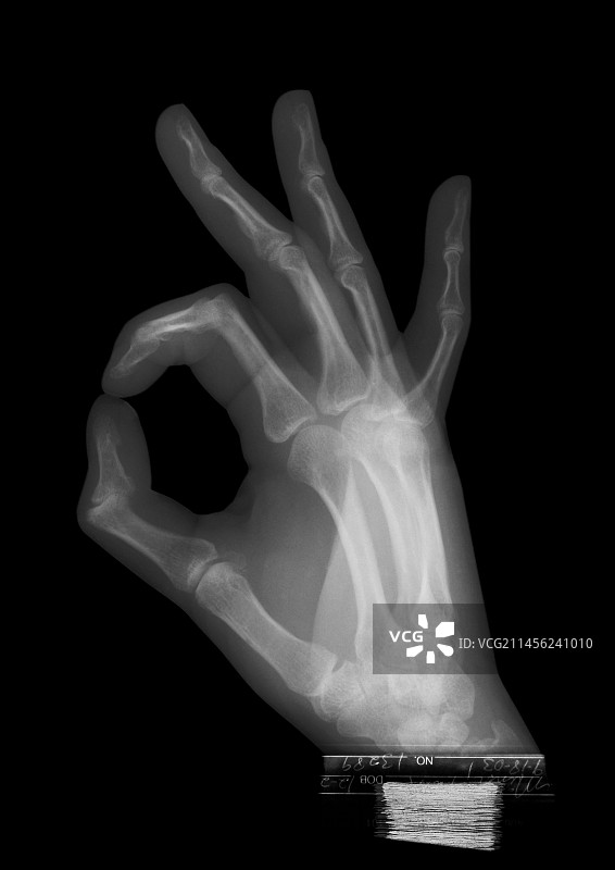 OK手势X光片图片素材