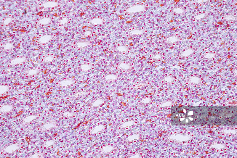 人体肾脏显微照片图片素材