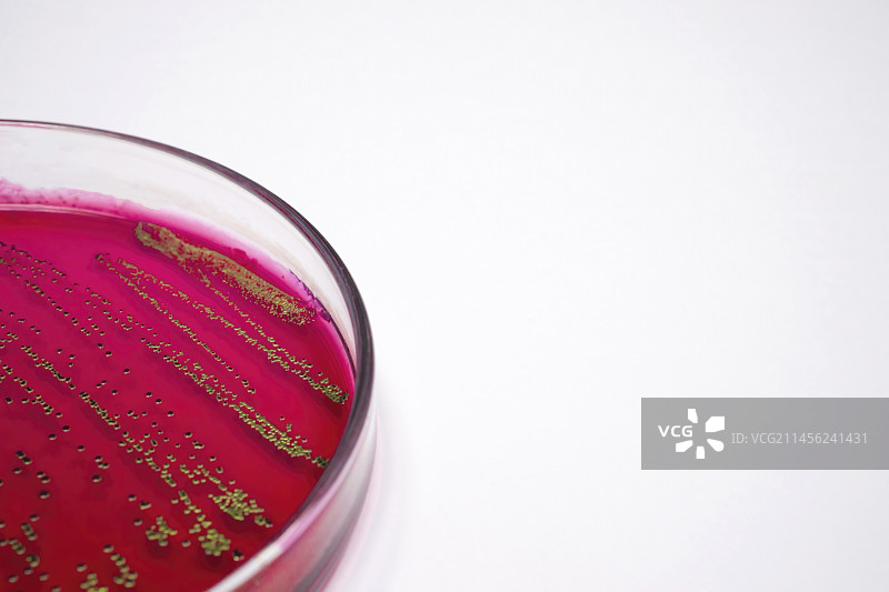 血琼脂上的大肠杆菌图片素材