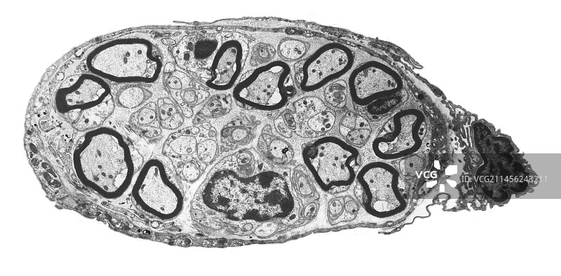 外周神经，TEM图片素材