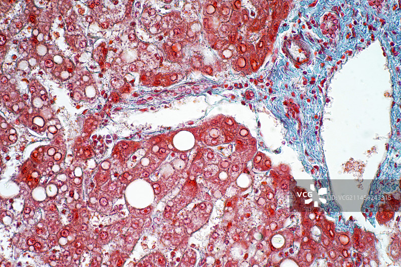 肝脏组织显微照片图片素材