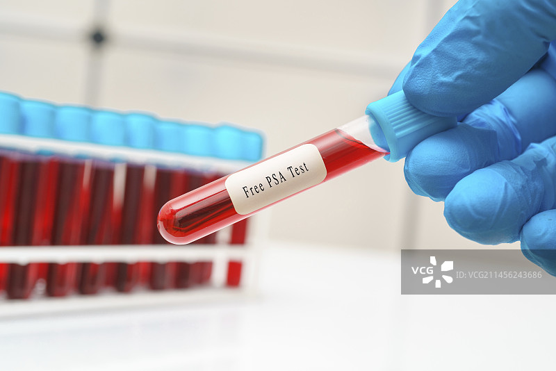 前列腺癌血液检测概念图图片素材