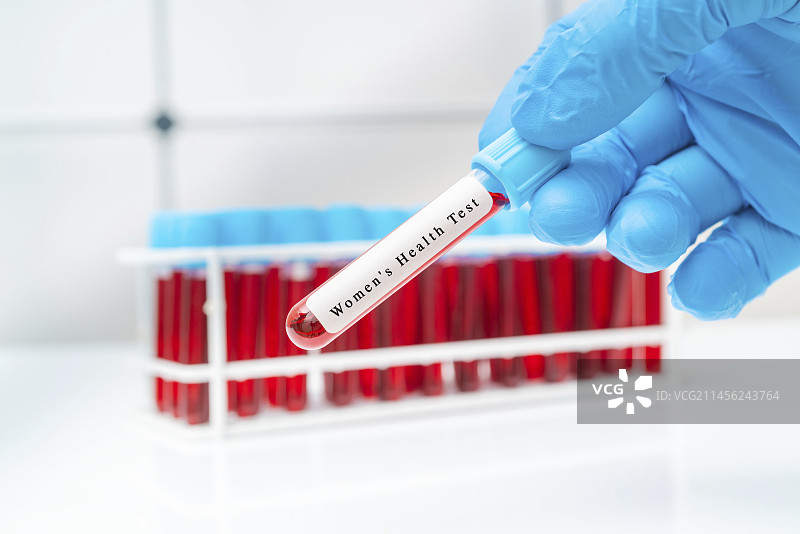 女性健康血液检测概念图图片素材