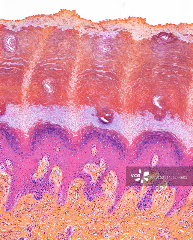 足底皮肤，LM图片素材