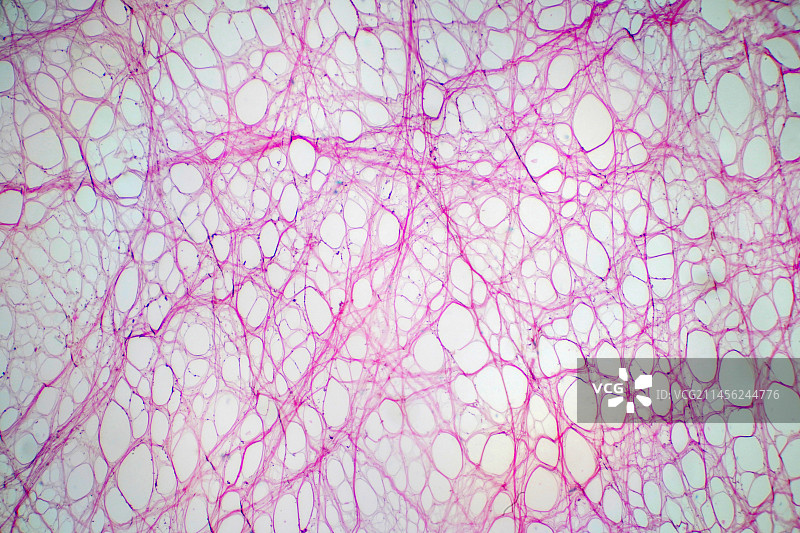 疏松结缔组织显微照片图片素材