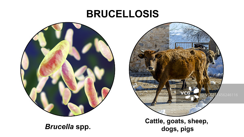 布鲁氏菌病插图图片素材