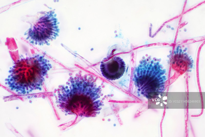 曲霉菌显微照片图片素材