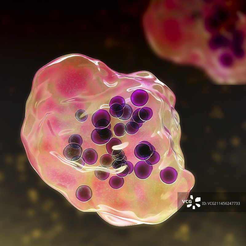 麻疹病毒感染，图示图片素材