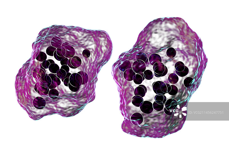 麻疹病毒感染，图示图片素材
