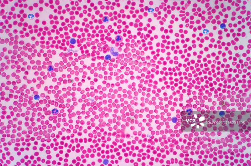 人类血细胞显微照片图片素材