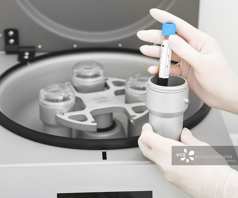 血浆提升过程图片素材