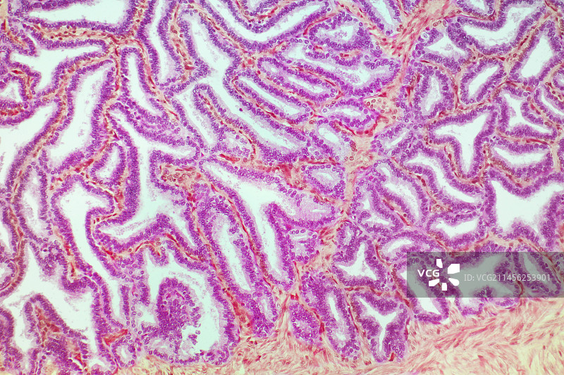 精囊，LM图片素材