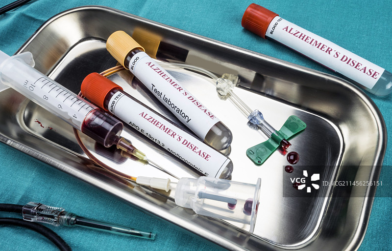 阿尔茨海默病研究概念图图片素材