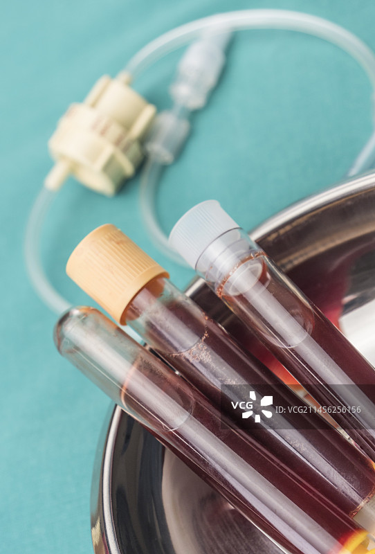 试管中的血液样本概念图图片素材