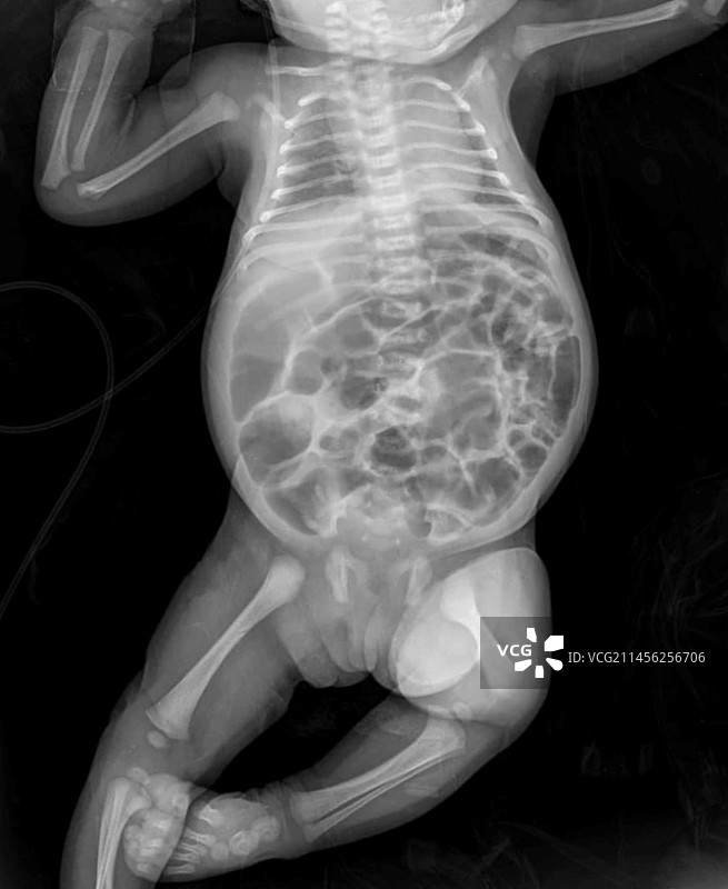 新生儿X光片图片素材