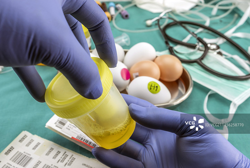 实验室技术员正在处理尿液样本图片素材