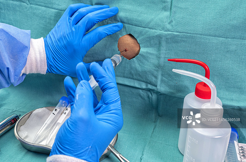 腰椎穿刺图片素材