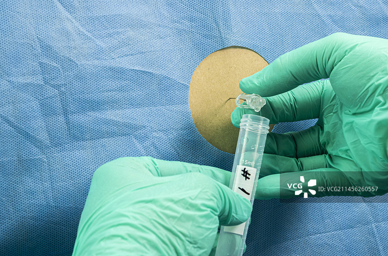 腰椎穿刺图片素材