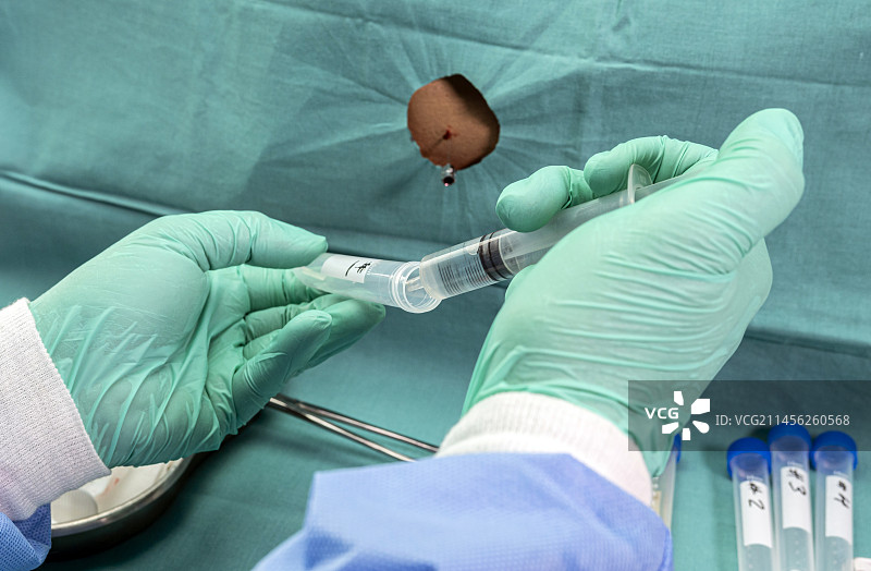 腰椎穿刺图片素材