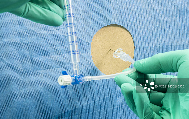 腰椎穿刺图片素材