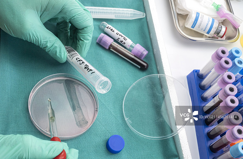 脑脊液样本测试图片素材