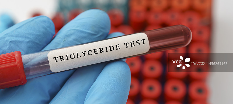 甘油三酯血液检测概念图图片素材