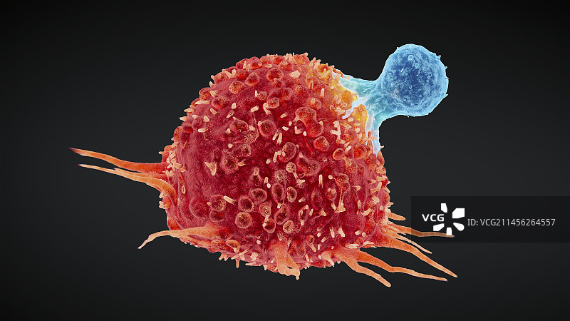 癌细胞的破坏，图示图片素材