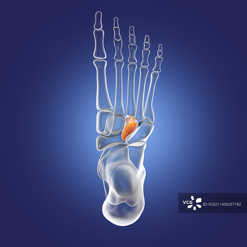 外侧楔骨图示图片素材