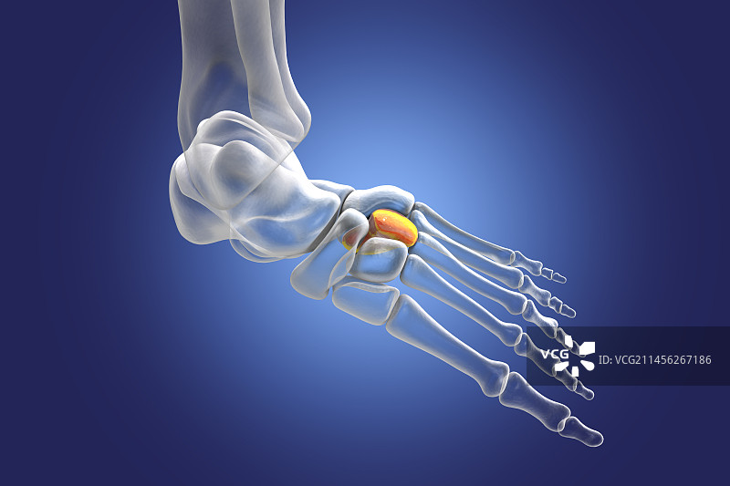外侧楔骨图示图片素材