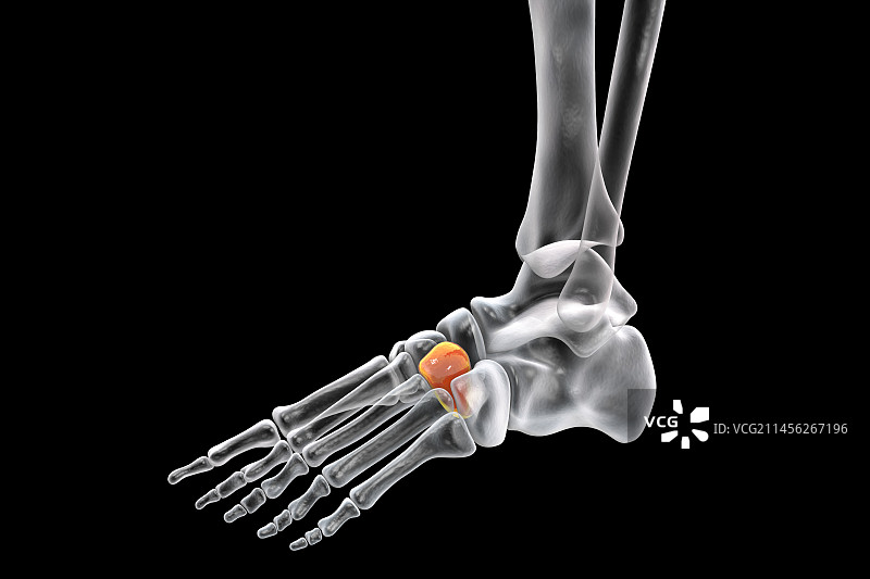 外侧楔骨图示图片素材