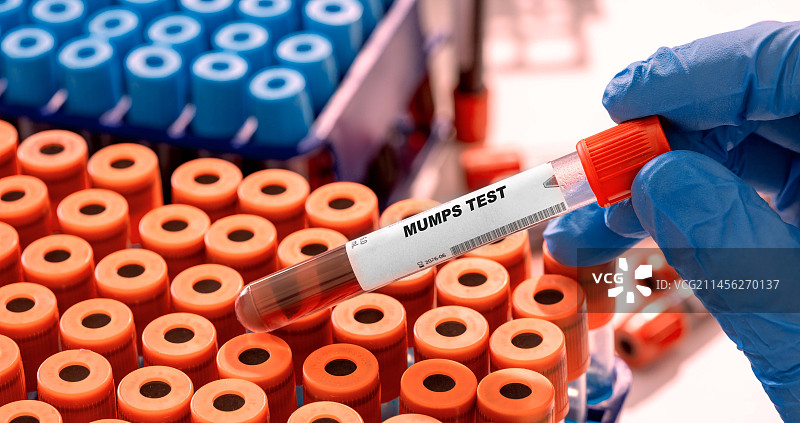 腮腺炎血液检测概念图图片素材