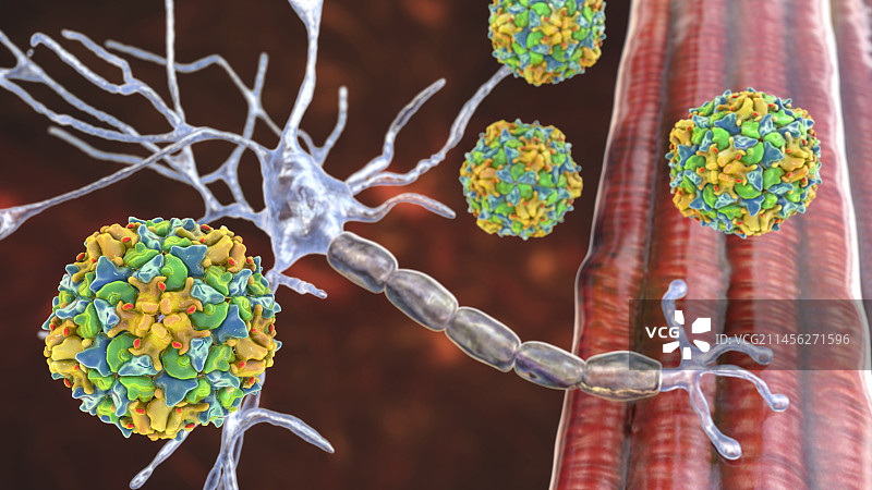 影响运动神经元的脊髓灰质炎病毒图片素材