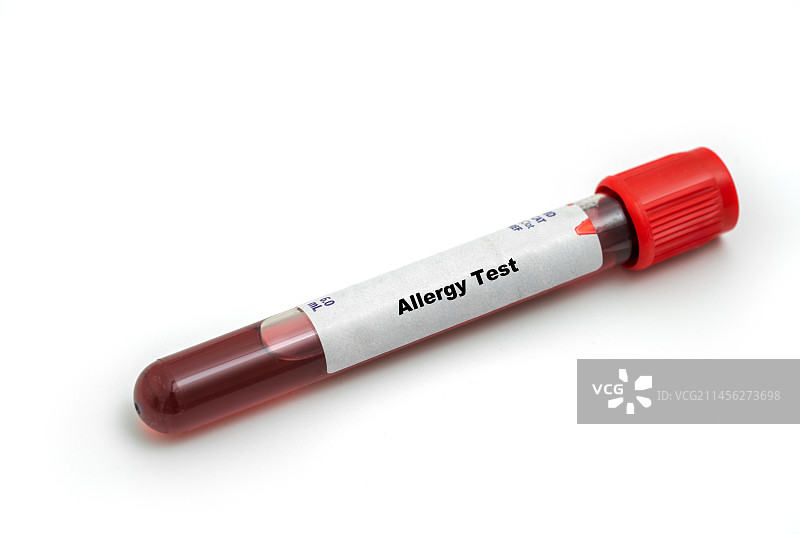过敏测试概念图图片素材
