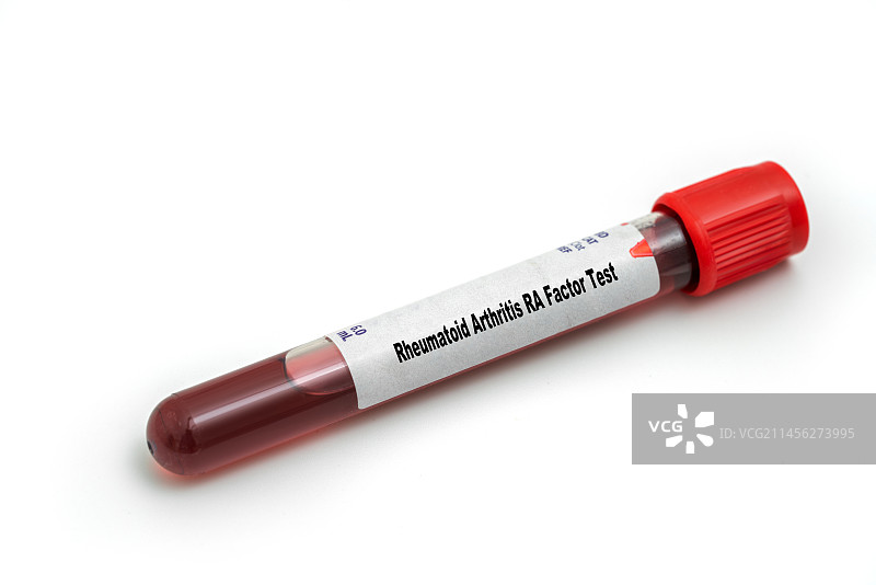 类风湿性关节炎因子测试概念图图片素材