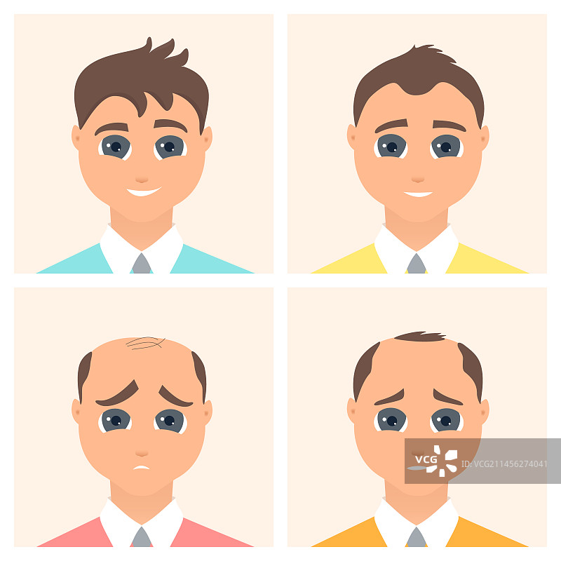 男性脱发阶段图示图片素材