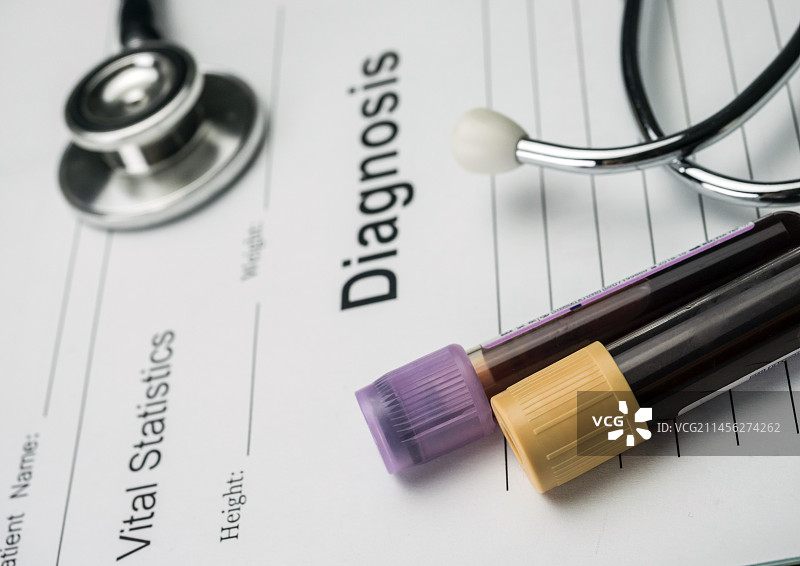 诊断表和血液样本试管图片素材