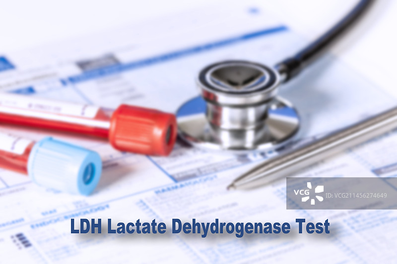 乳酸脱氢酶测试概念图图片素材