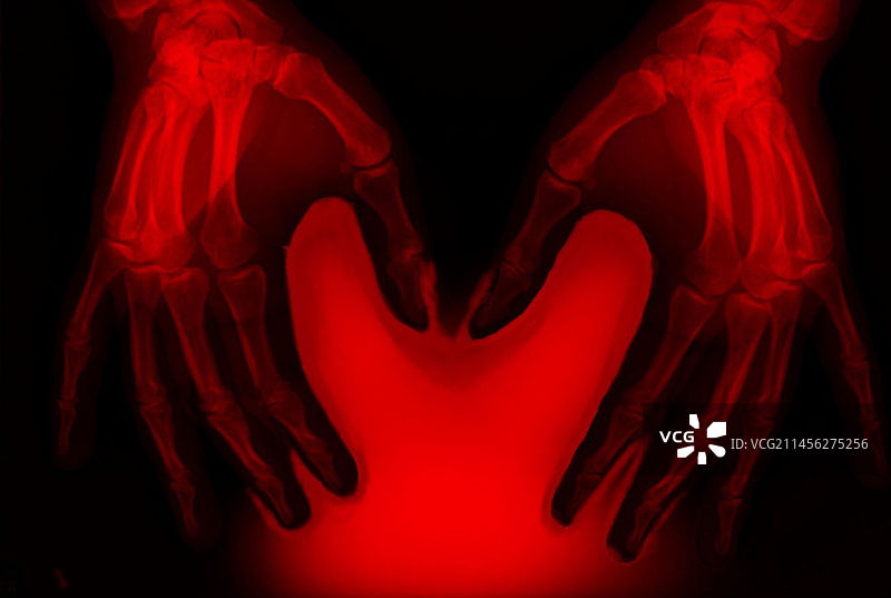 手部X光片图片素材