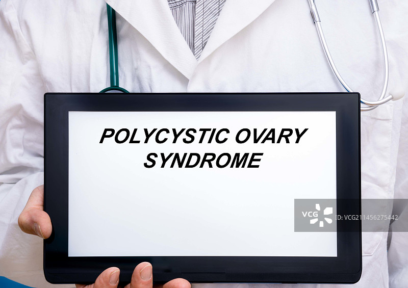 多囊卵巢综合征概念图图片素材