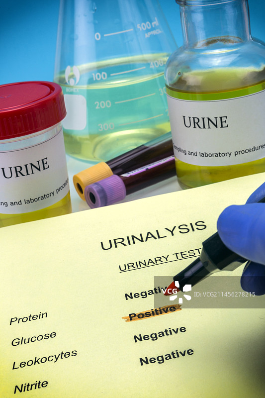 尿液测试概念图图片素材