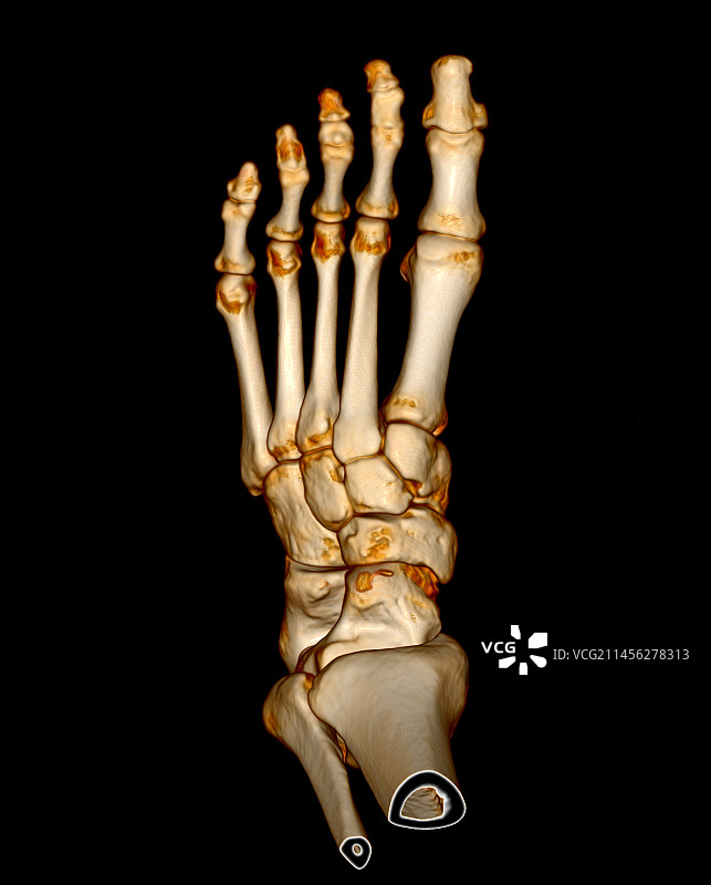 脚部3D CT扫描图片素材