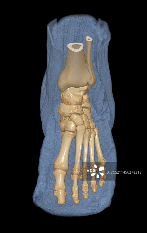 脚部3D CT扫描图片素材