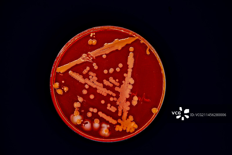 培养皿中培养的细菌图片素材