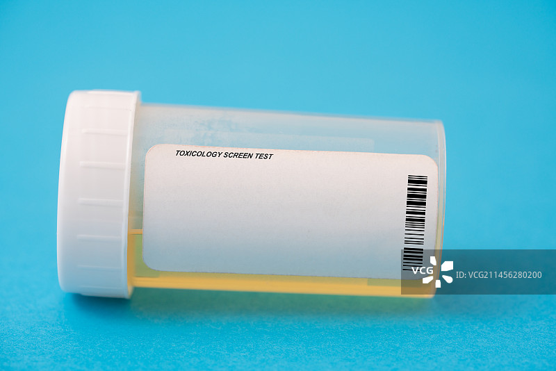 尿液样本图片素材